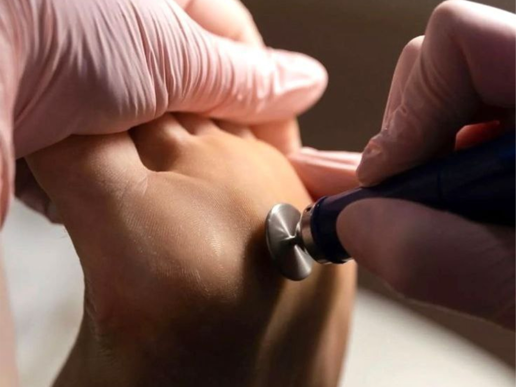 Подологический педикюр